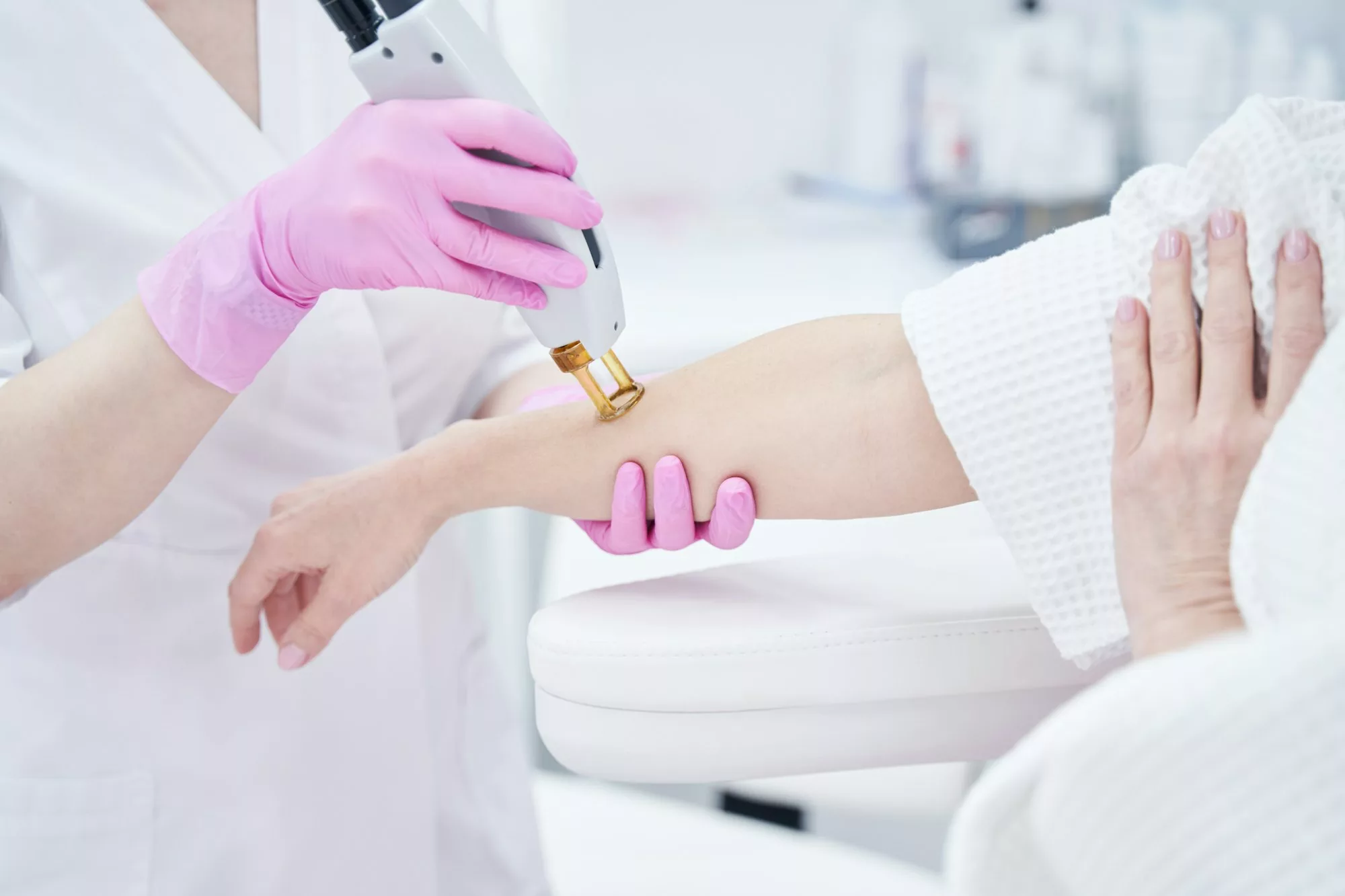 Beautician removing hair from woman arm with laser device